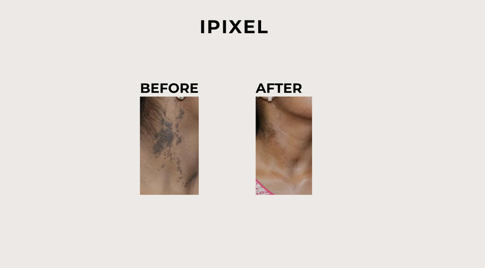 imageye___-_imgi_6_imgi_6_30 (10)