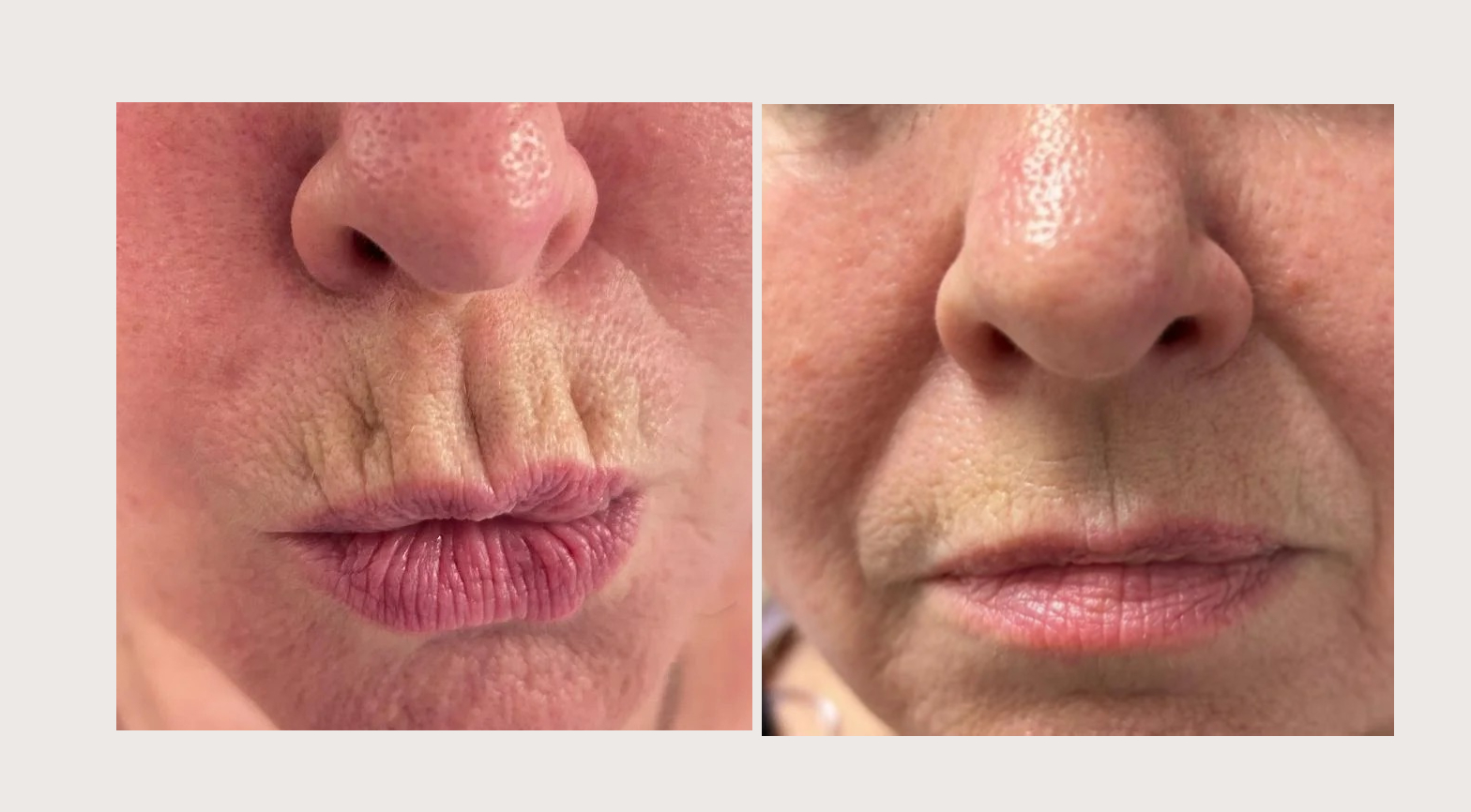 imageye___-_imgi_6_imgi_6_30 (2)