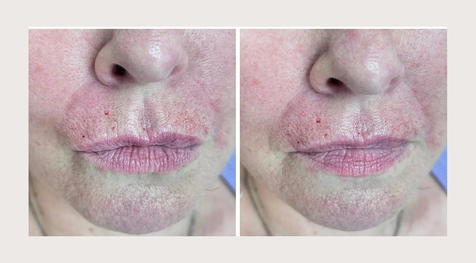 imageye___-_imgi_6_imgi_6_30 (3)