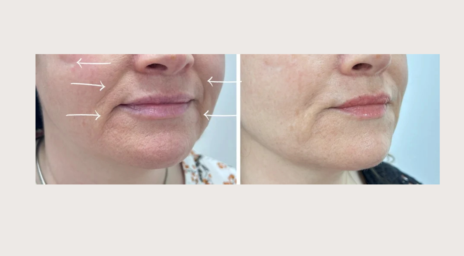 imageye___-_imgi_6_imgi_6_30 (4)