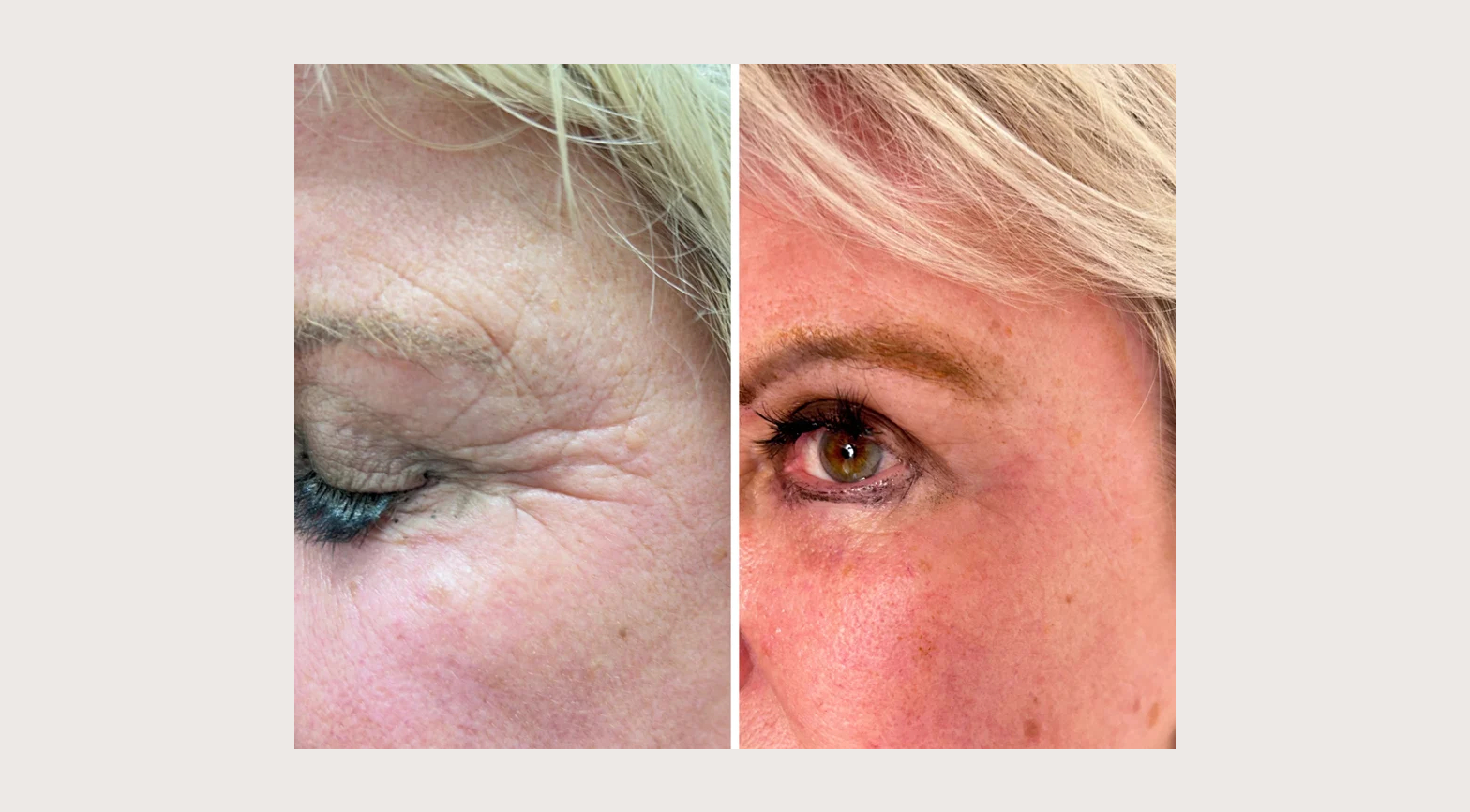 imageye___-_imgi_6_imgi_6_30 (7)