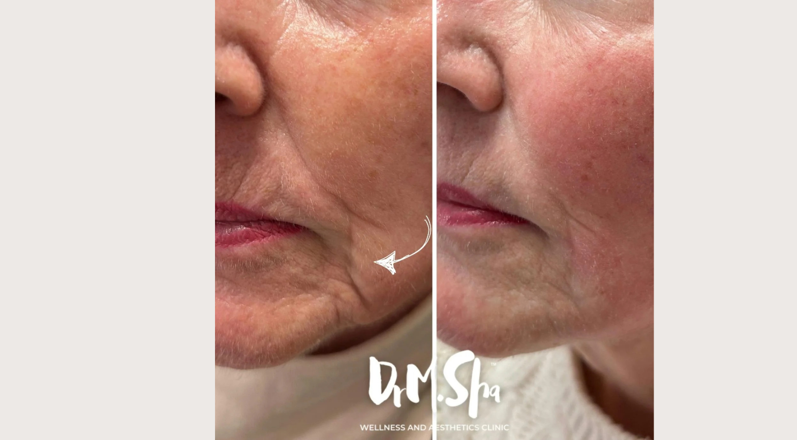 imageye___-_imgi_6_imgi_6_30 (8)