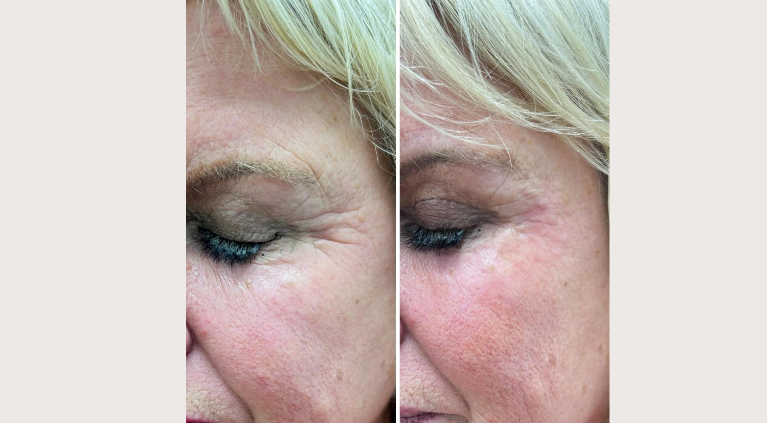 imageye___-_imgi_6_imgi_6_30 (9)