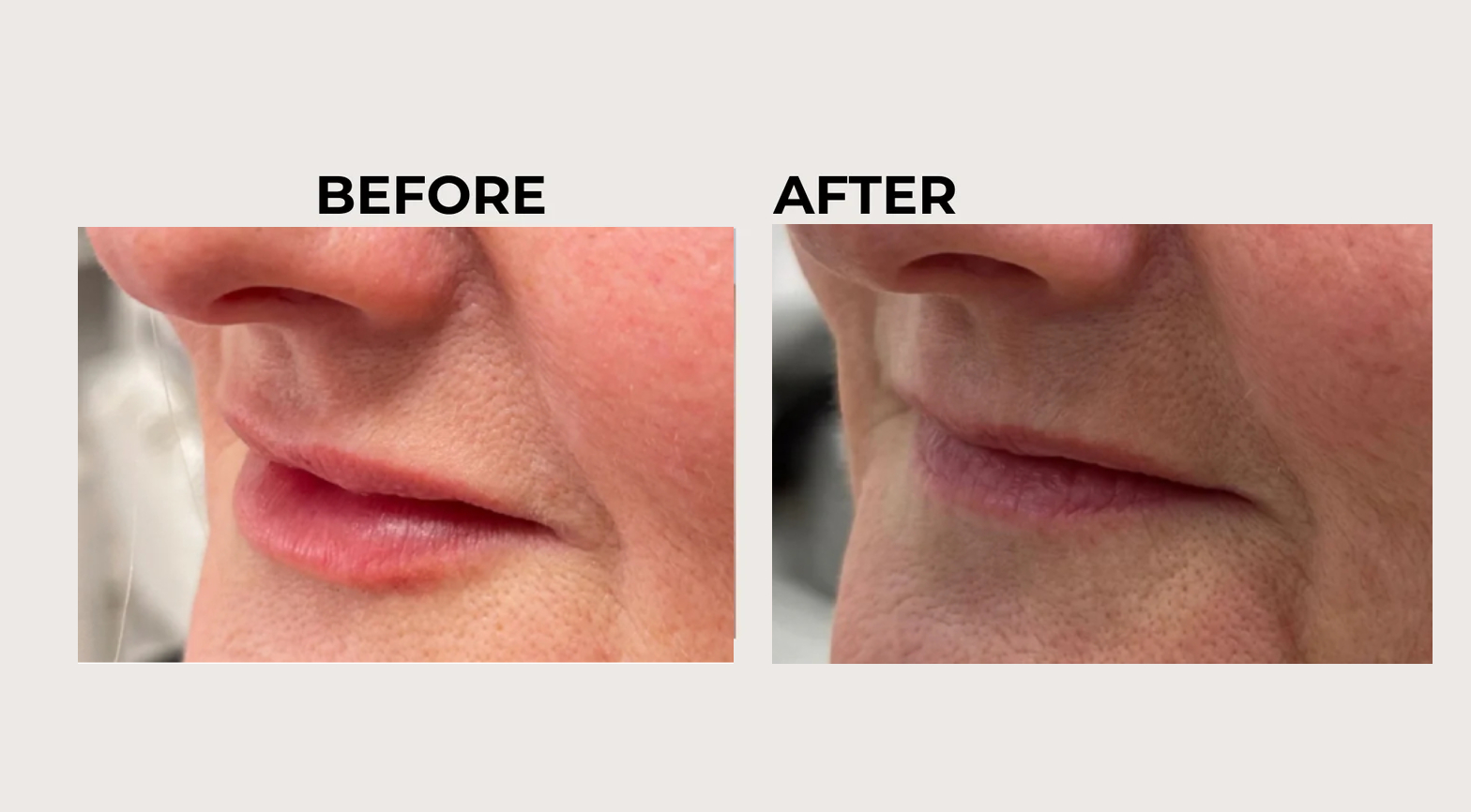 imageye___-_imgi_6_imgi_6_30